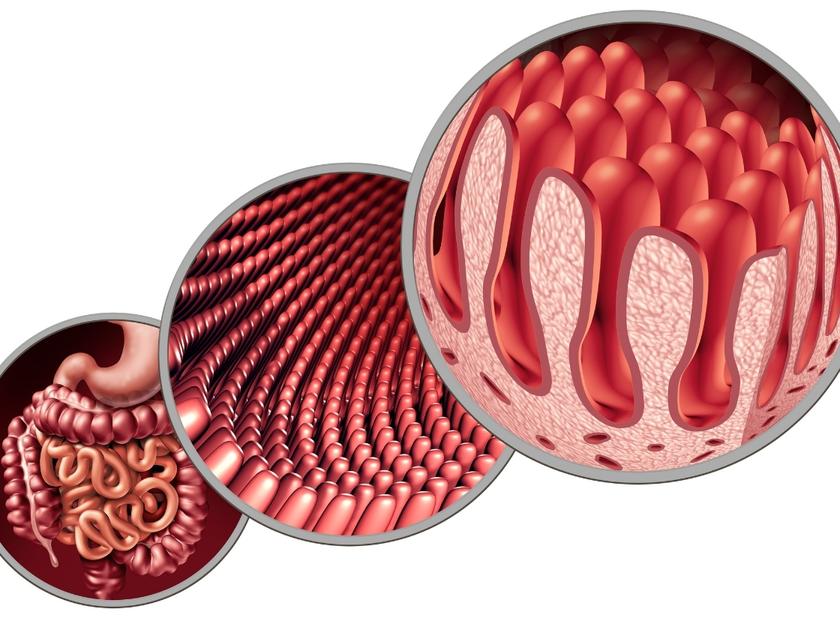 best-intestinal-obstruction-perforation-treatment-meerpet